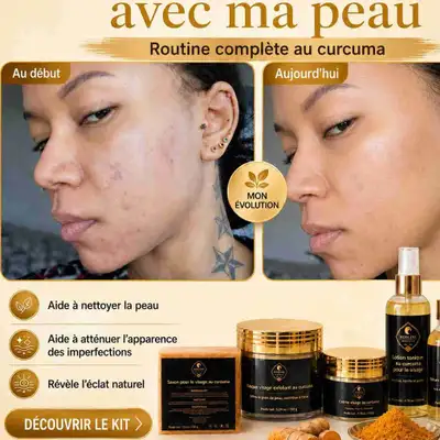 Kit visage au curcuma ( boutons, tâches, teint terne), View more