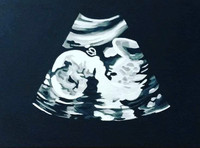 Custom Ultrasound Paintings on Canvas