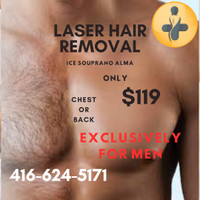 Hair removal laser