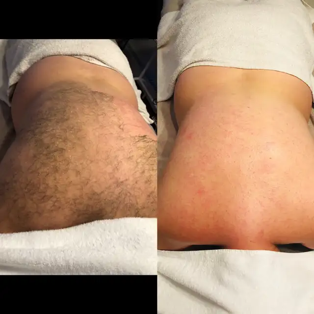 Manzilian Waxing for Men | Experienced & Welcoming Esthetician in Health and Beauty Services in Ottawa - Image 7
