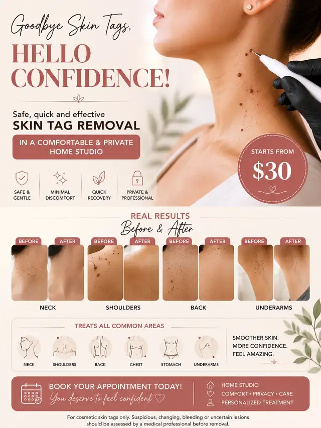 Professional Skin Tag Removal Services