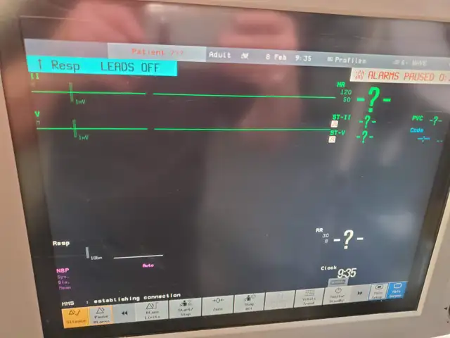 Philips MP70 Monitor W/ M3001A Module in Other in Calgary - Image 7