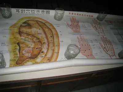 Acupuncture Posters, Books, Notes, Needles, View more