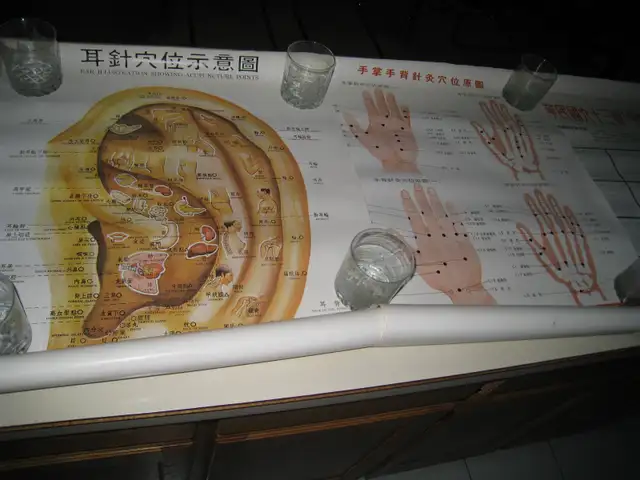 Acupuncture Posters, Books, Notes, Needles in Textbooks in Vancouver - Image 2