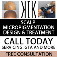 ⭐ Scalp Micropigmentation - Design & Treatment - Call Today ⭐