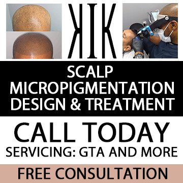 ⭐ Scalp Micropigmentation - Design & Treatment - Call Today ⭐ in Health and Beauty Services in Oshawa / Durham Region