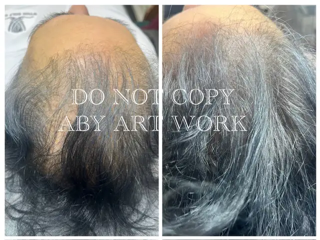 Thin Hair? Crown Issues? I Fix That-Mobile service.64551238985475120