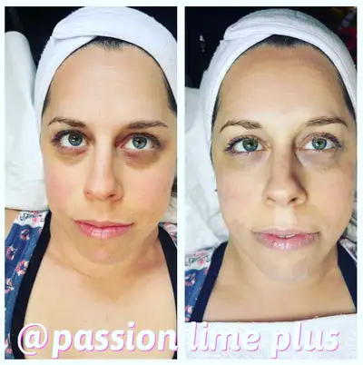 Soins du visage HYDRATANT,Detox, glow Longueuil, View more