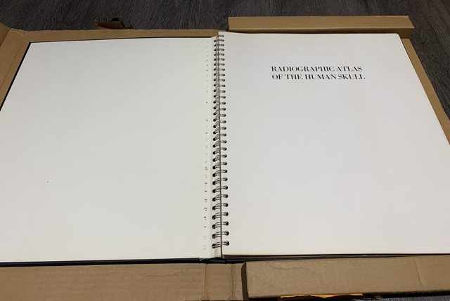 NEW Vintage Radiographic Atlas of the Human Skull First edition in Textbooks in Markham / York Region - Image 2