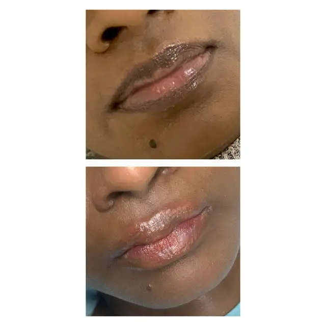 Lip blush Neutralization 523497451491184641