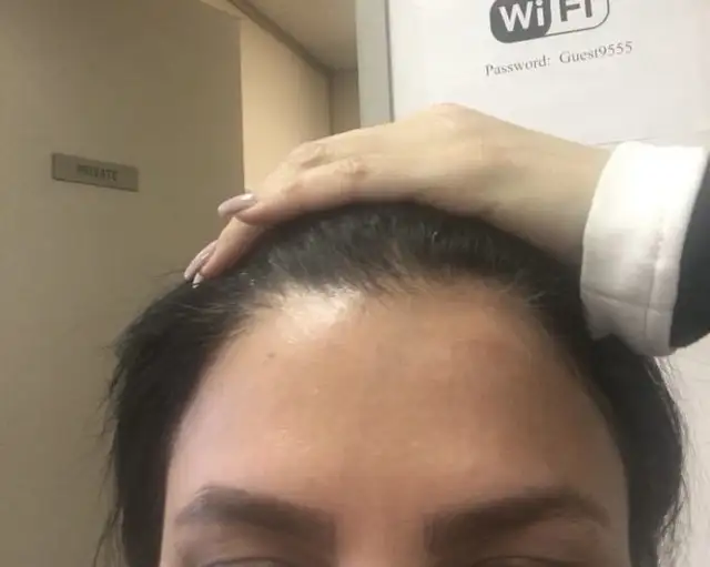 PROMOTIONS BOTOX 4.5$ per unit FILLER 270$  MOBILE SERVICES GTA in Health and Beauty Services in City of Toronto - Image 4