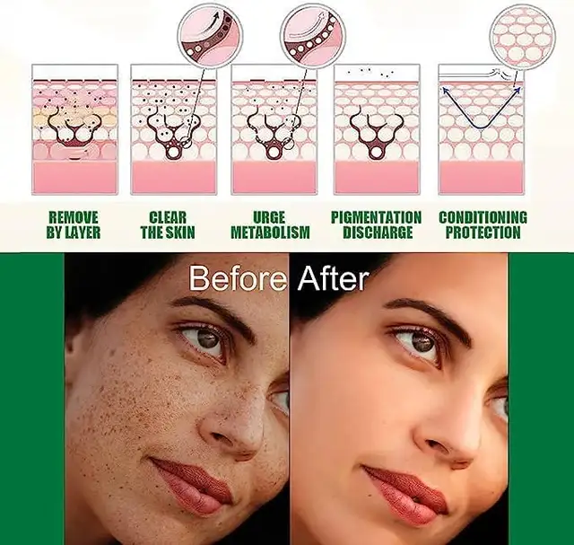Dark Spot Correcting Glow Serum Face Skin Serum for Dark Spot
