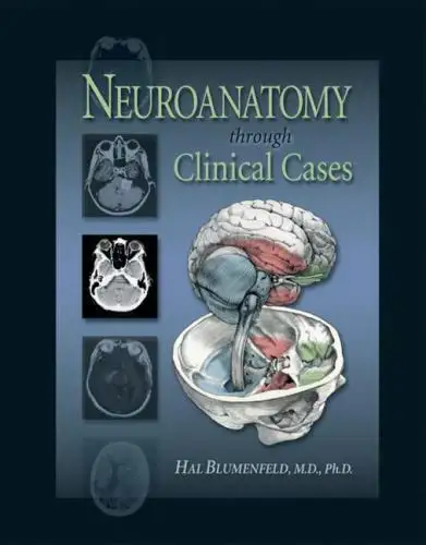 Neuroanatomy Through Clinical Cases 1st Edition by H. Blumenfeld, View more