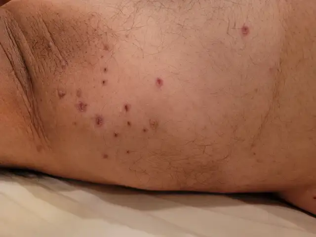 Professional Massage & Skin Tags Remove63848993402371124