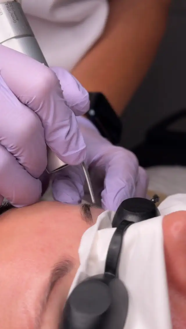 Laser tattoo removal63234961383811122