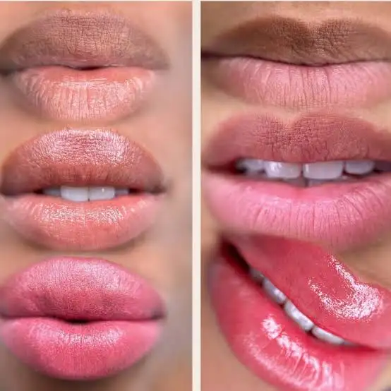 FREE MODEL WANTED – LIP NEUTRALIZATION