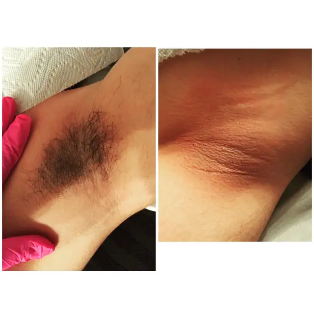 Manzilian Waxing for Men | Experienced & Welcoming Esthetician in Health and Beauty Services in Ottawa - Image 4