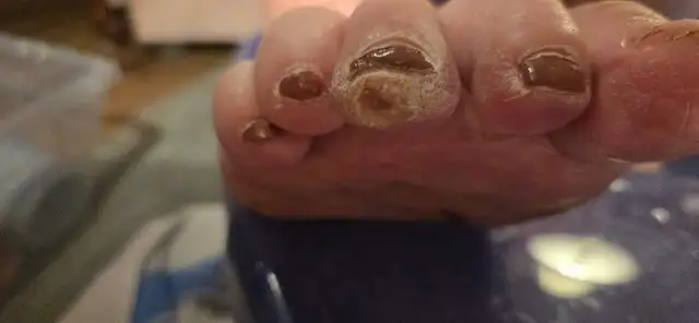Mobile Advanced Footcare64985458817409128