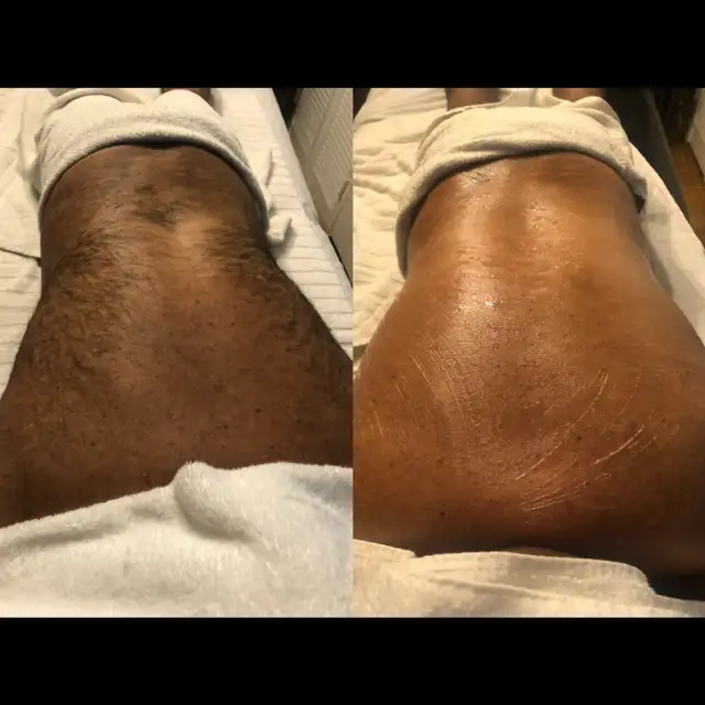 Manzilian Waxing for Men | Experienced & Welcoming Esthetician in Health and Beauty Services in Ottawa - Image 5