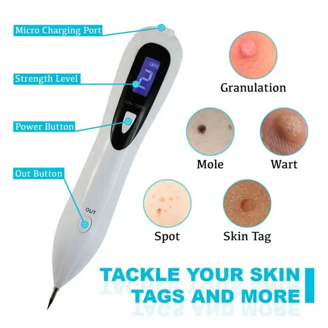 Electronic Skin Tag Remover, Skin Tags Removal Pen in Other in City of Montréal - Image 4