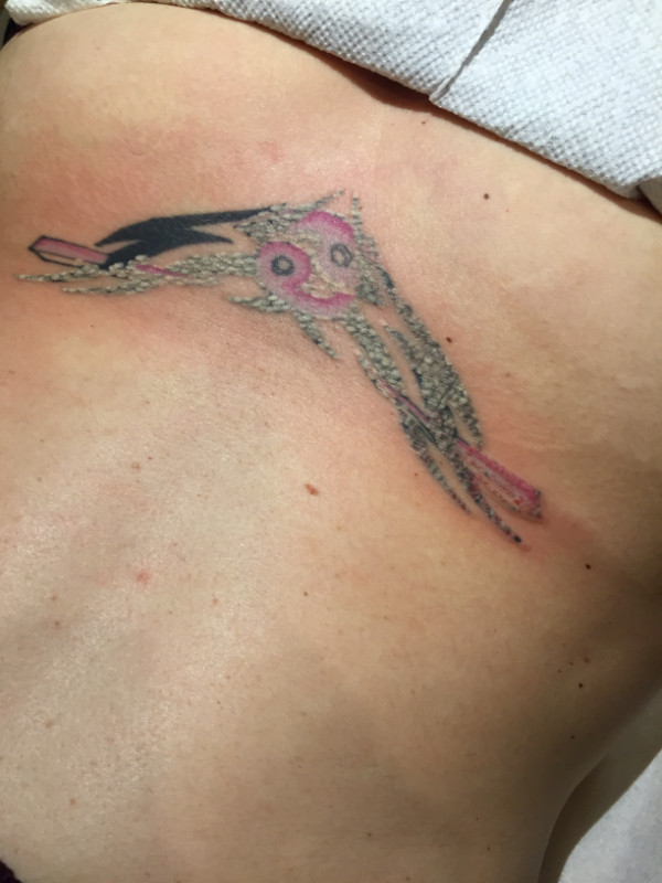 Tattoo Removal Laser - Easy to Operate Equipment in Health & Special Needs in Victoria - Image 2