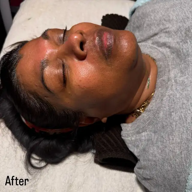 Dermaplane Facials - GTA - Mobile Esthetician62863244454786124