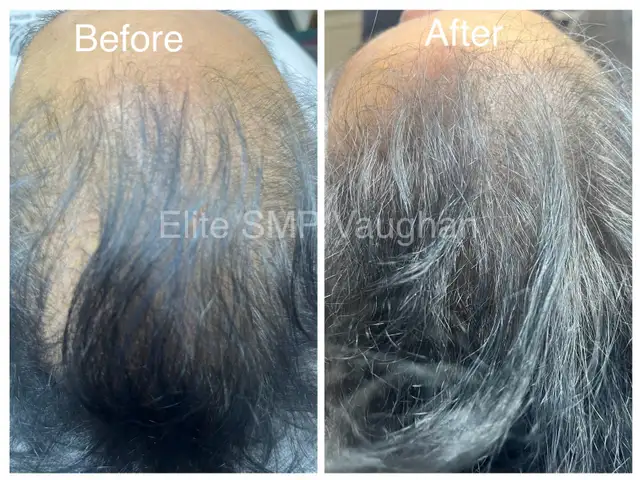 BETTER  THAN HAIR TRANSPLANT63436968683139121