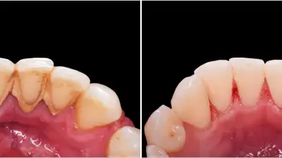 FREE Dental Check-up and Cleaning + Get Paid!, View more