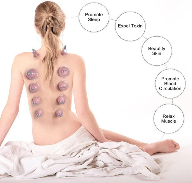 Ensemble Thérapie Professionnelle Ventouses Hijama Cupping set dans Santé et besoins spéciaux  à Ville de Montréal - Image 2