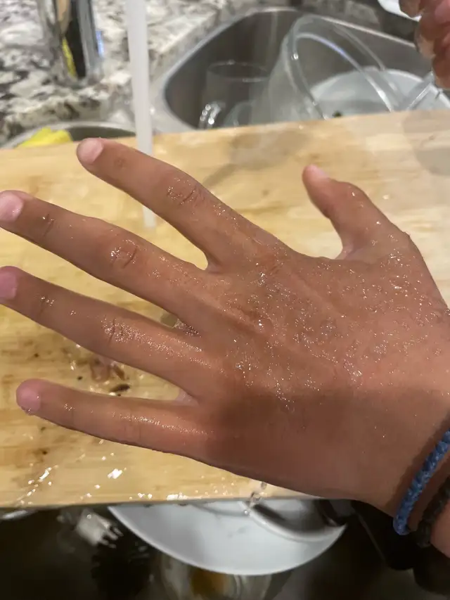 Two hands462792254114375680