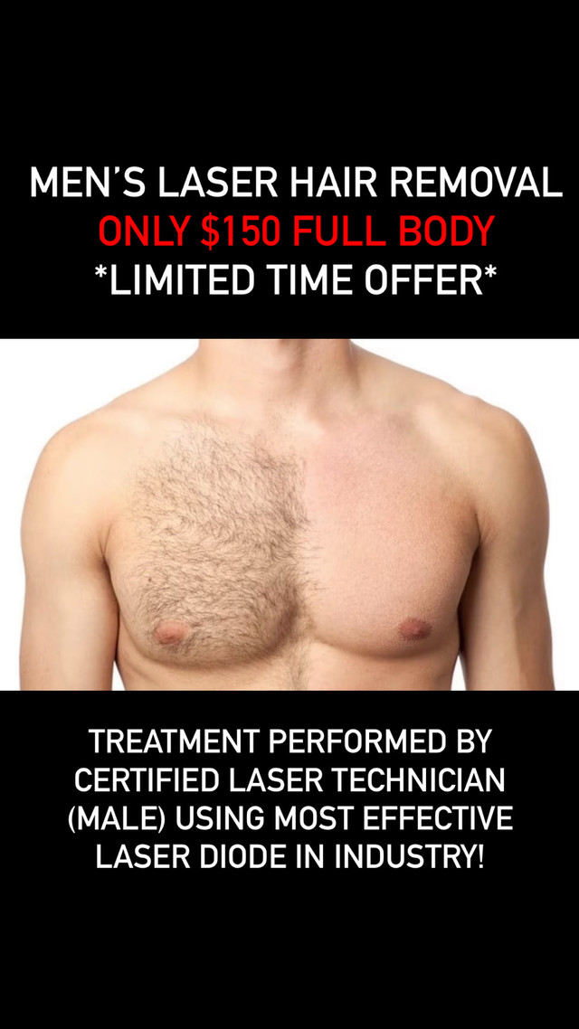 $170 Men Laser Hair Removal - Male Tech in Health & Special Needs in Mississauga / Peel Region - Image 3