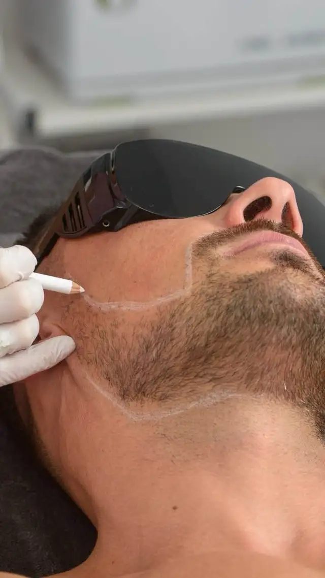 Laser Hair Removal for Face & Body