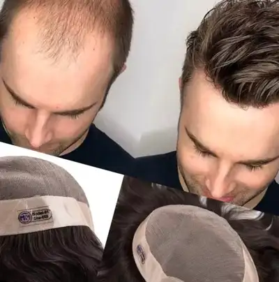 Men’s wig / Touppe Confidence Starts at the Top. Rediscover Yours. Thinning hair? Receding hairline?...