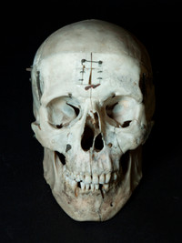 Human Skull with Articulations