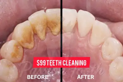 nervous, anxious? want a full private dental cleaning session?, View more