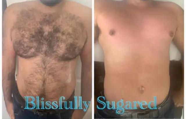 Professional Hair Removal and Teeth Whitening , Summer Promos !62863229619585122