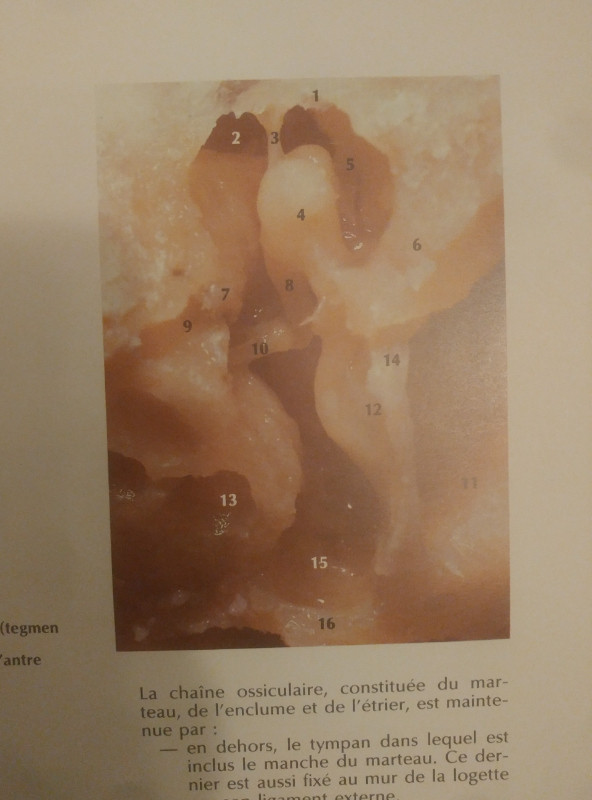Atlas commenté d'otoscopie. Pathologie du conduit auditif ext... dans Manuels  à Longueuil/Rive Sud - Image 3
