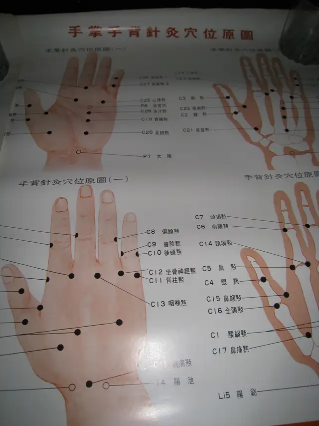 Acupuncture Posters, Books, Notes, Needles in Textbooks in Vancouver - Image 4