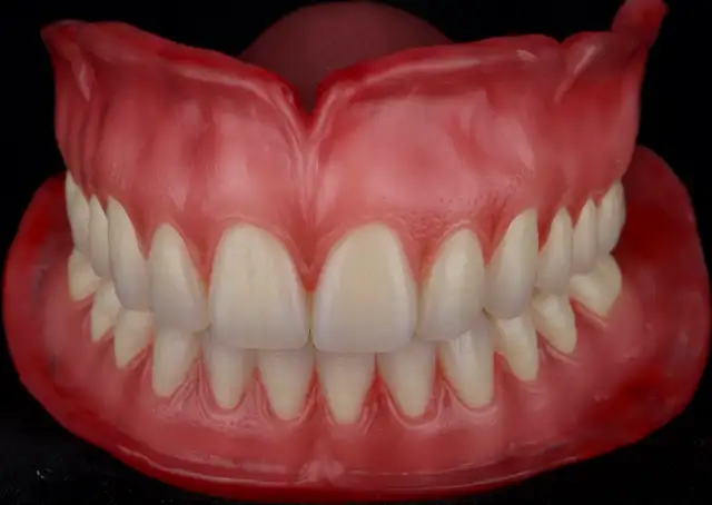 Free Complete Dentures63006659084801122