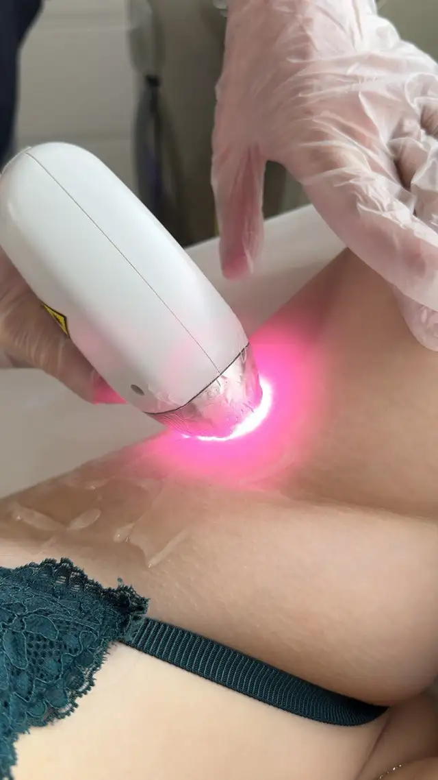 Waxing, Sugaring and Laser for women and men in Etobicoke in Health and Beauty Services in City of Toronto - Image 3