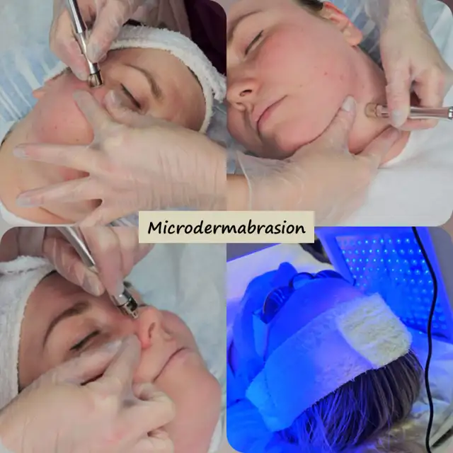 FACE MASSAGE (Sculptural*Plastic*Buccal*Myofascial), FACIAL/PEEL in Health and Beauty Services in City of Toronto - Image 5