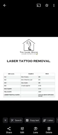 Tattoo Removal 