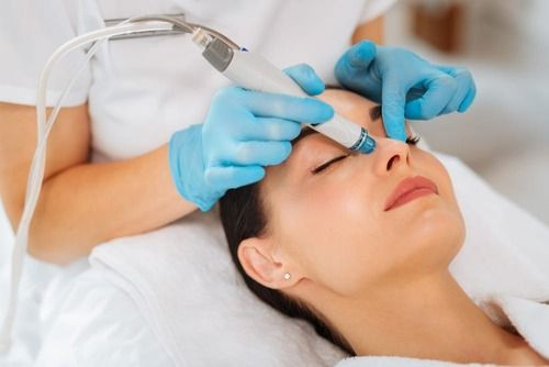 $89 RF Facials in  Vaughan in Health and Beauty Services in Markham / York Region