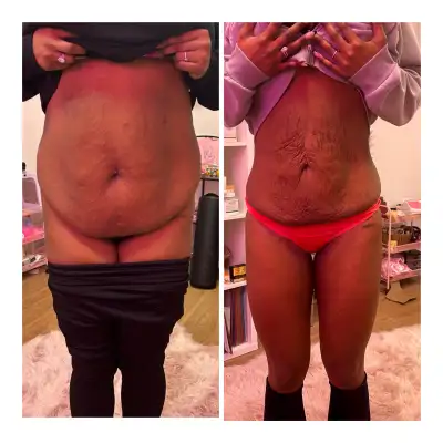 Glow • Sculpt • Lift – The Ultimate Body Contouring Experience, View more