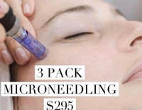 Microneedling 3 For $295