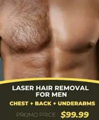 Male laser hair removal Promo sale  