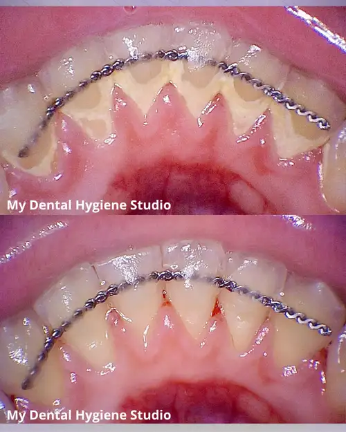 Looking for gentle, thorough, and personalized dental care? Welcome to My Dental Hygiene Studio, whe...