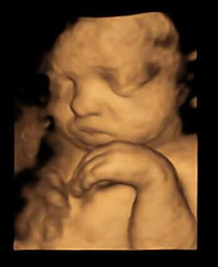 3D 4D Baby Visuals ultrasound 