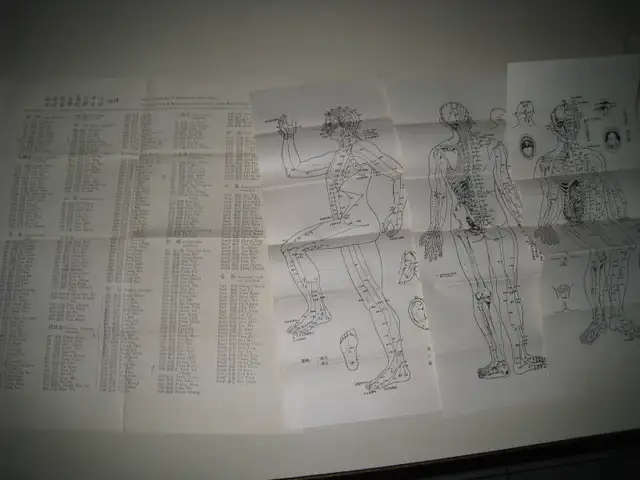 Acupuncture Posters, Books, Notes, Needles in Textbooks in Vancouver - Image 6