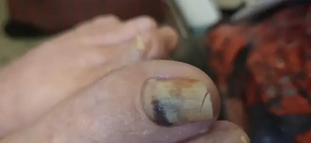 Mobile Advanced Footcare64985458817409125